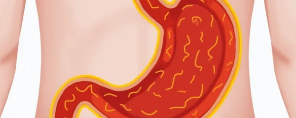 can-ibs-cause-a-burning-stomach-sensation